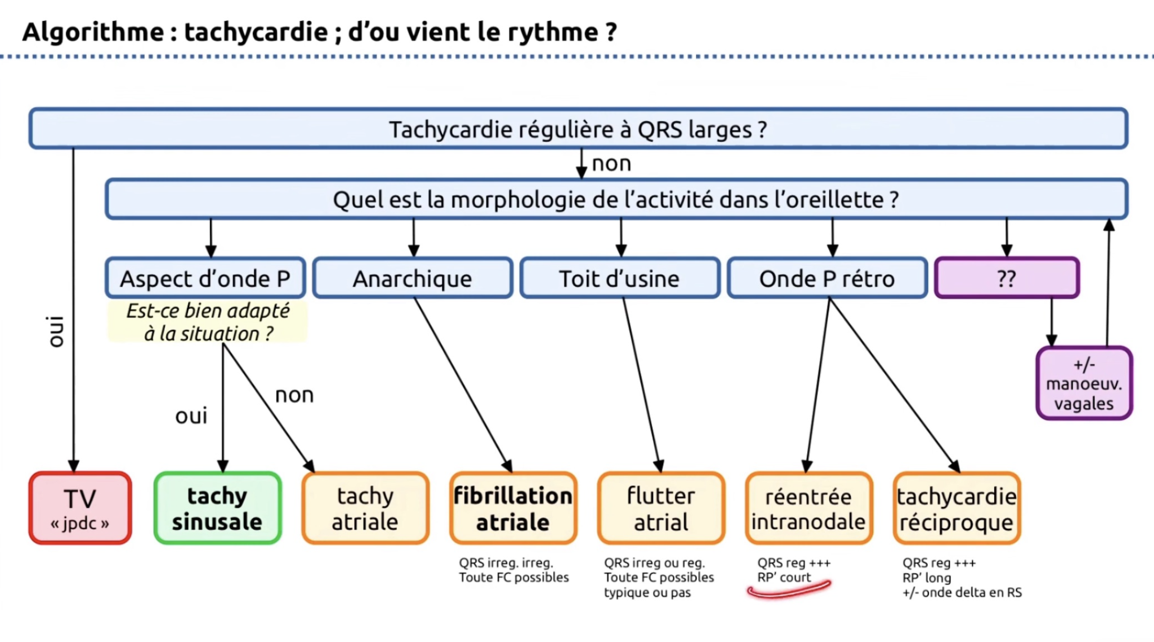 Algorithme tachycardie — origine du rythme