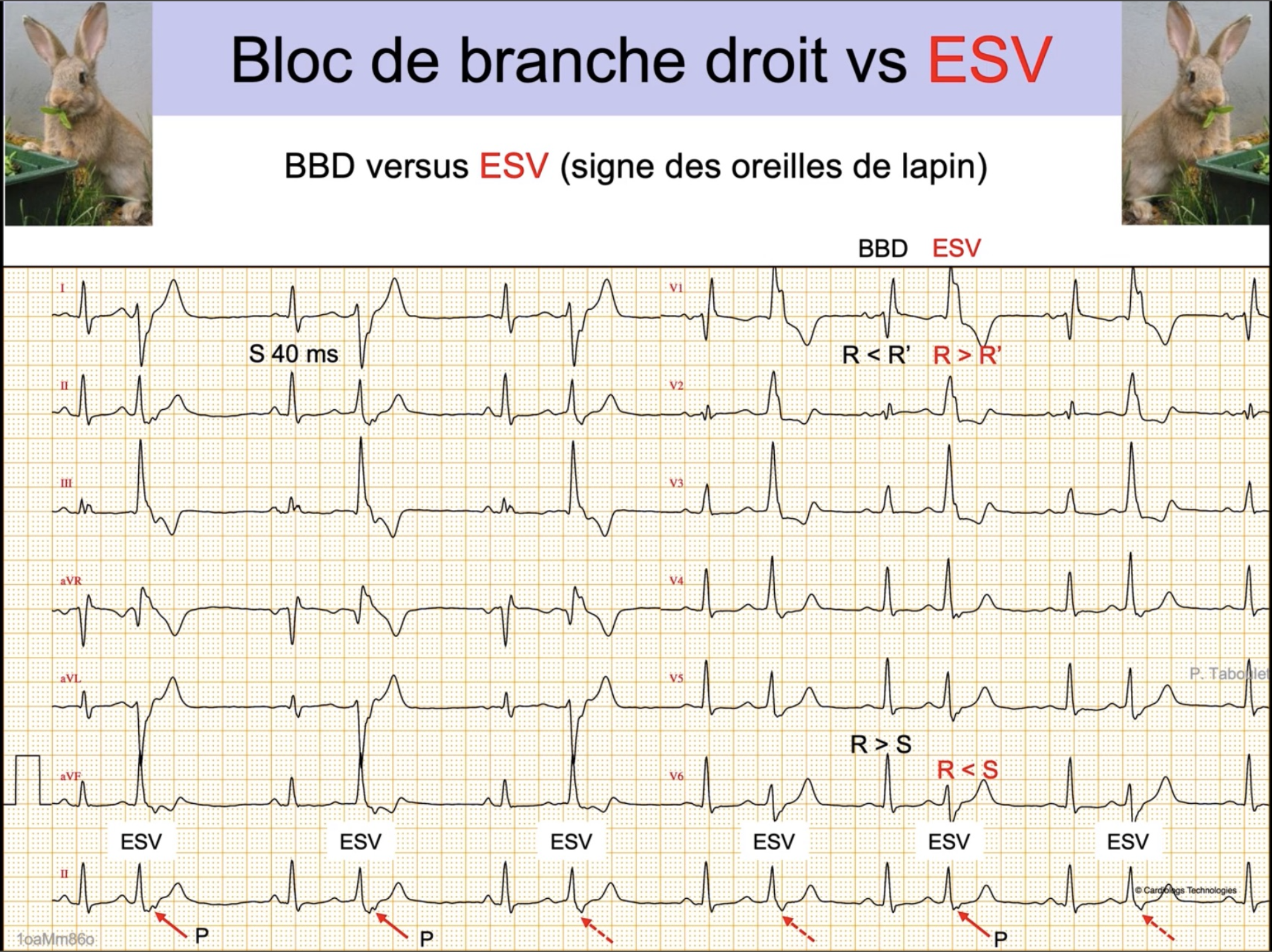 BBD vs ESV — oreilles de lapin