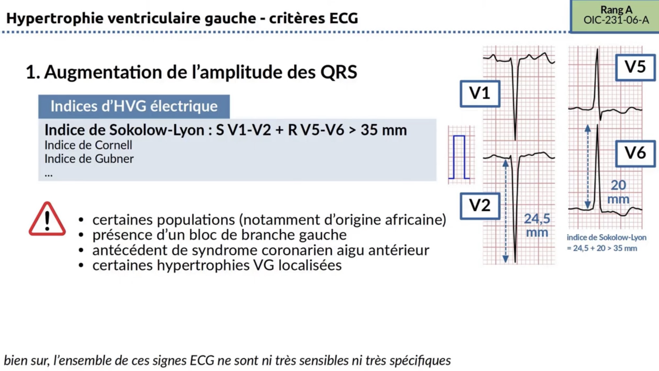 HVG critères ECG — indice Sokolow-Lyon